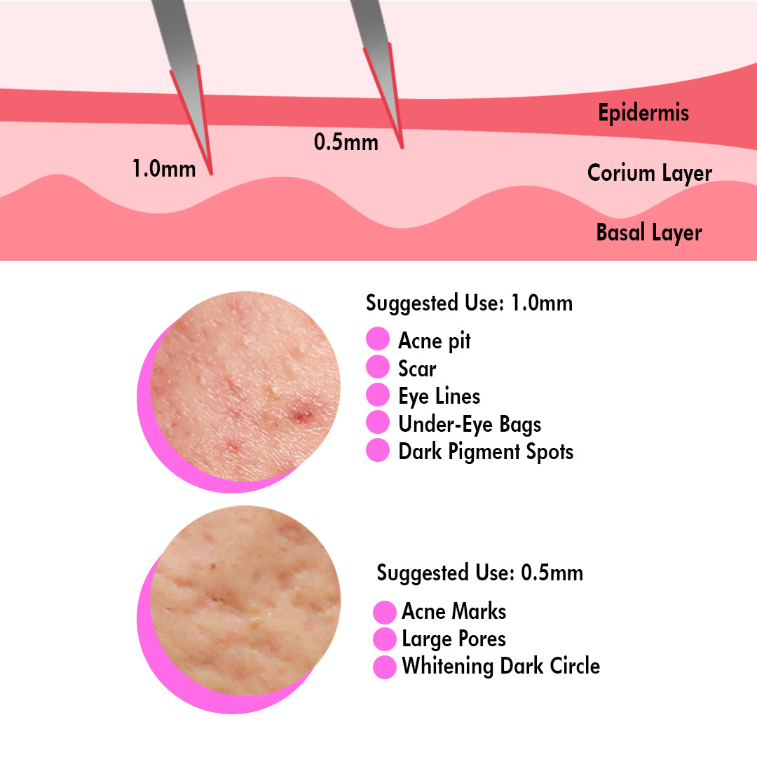 0.5 MM Dermaroller 540 Titanium Micro Needle Roller (Silver)