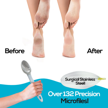 Foot Care Set – Callus Remover, Heel File & Ergonomic Handle bu nasıl