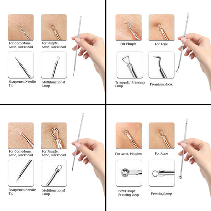 4 PCS Stainless Steel Blackhead Remover Comedone Set